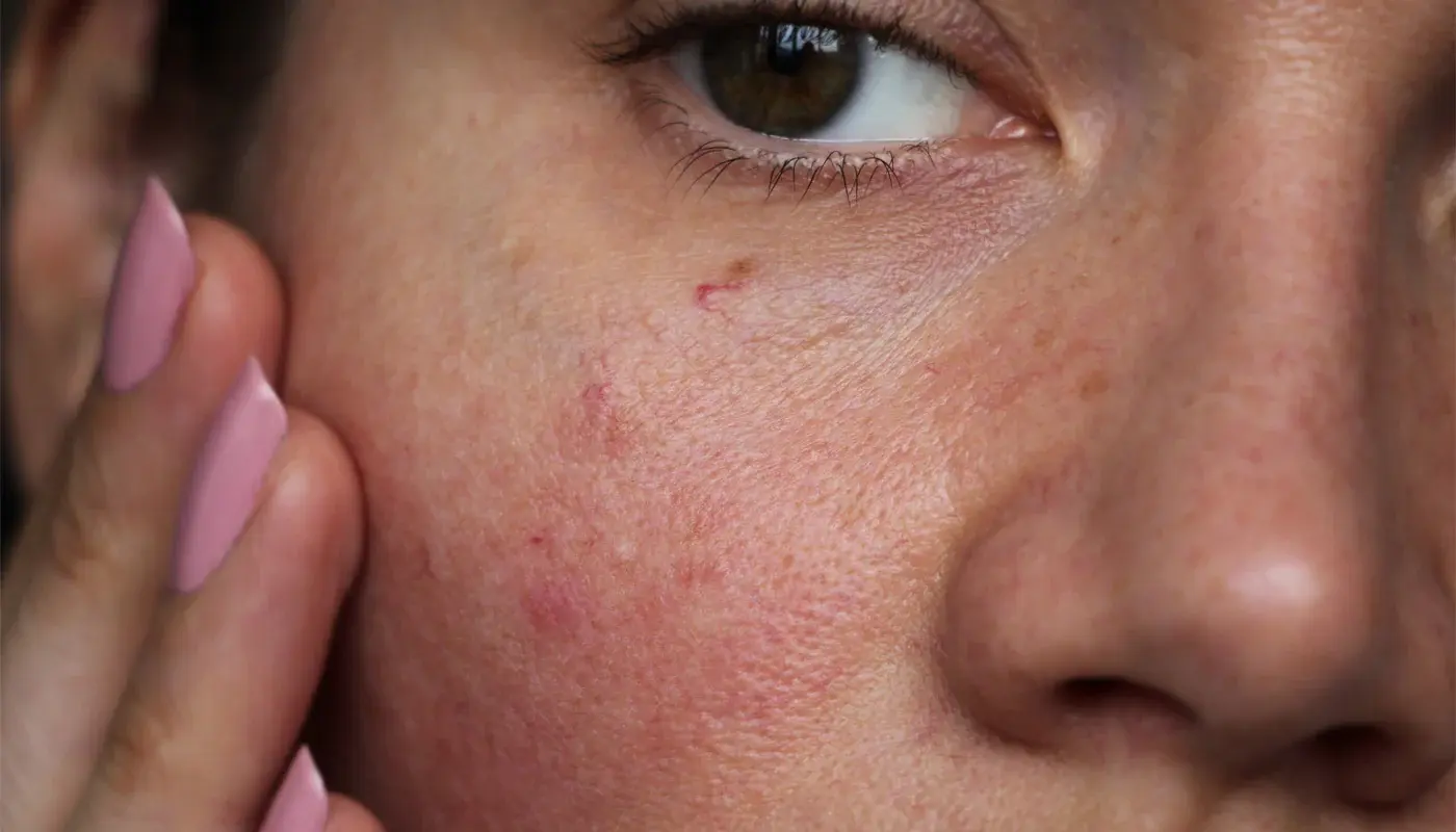 Dry & Sensitive Skin secondary product