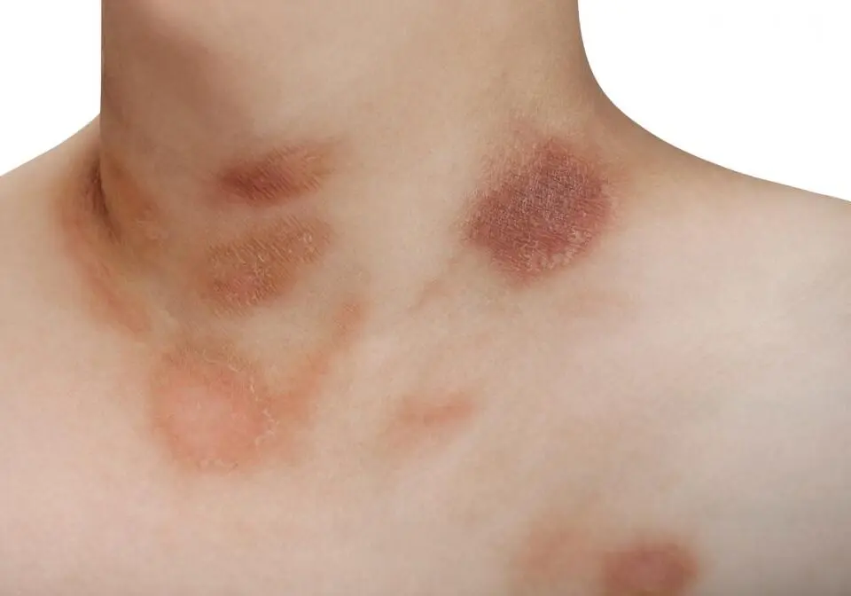 Infections & Skin Conditions product