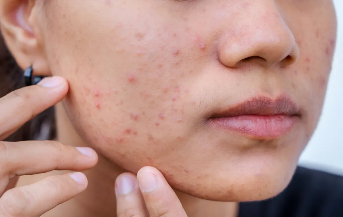 Infections & Skin Conditions secondary product